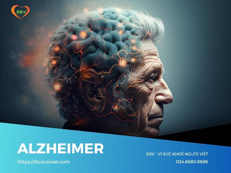 Bệnh lý Alzheimer