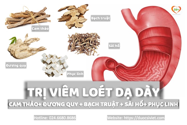 trị viêm loét dạ dày