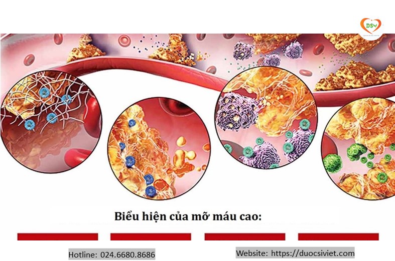 các bài thuốc đông y giúp hạ mỡ máu