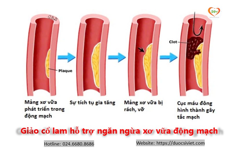 Giảo cổ lam giúp ngăn ngừa hỗ trợ 