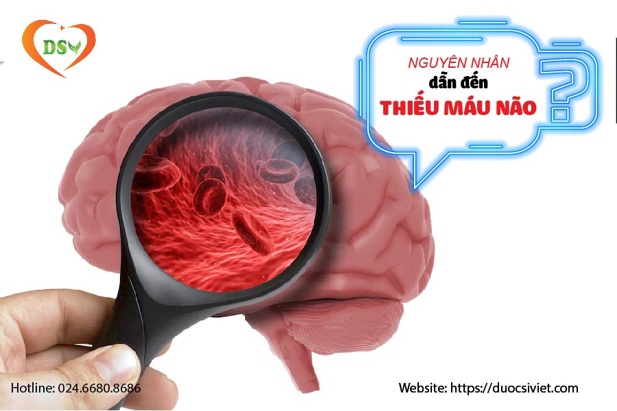 NGUYÊN NHÂN dẫn đến THIẾU MÁU NÃO