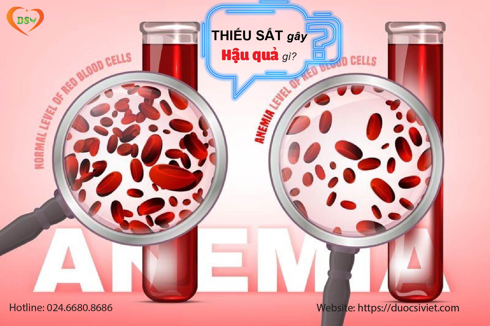 Thiếu sắt gây hậu quả gì? 
