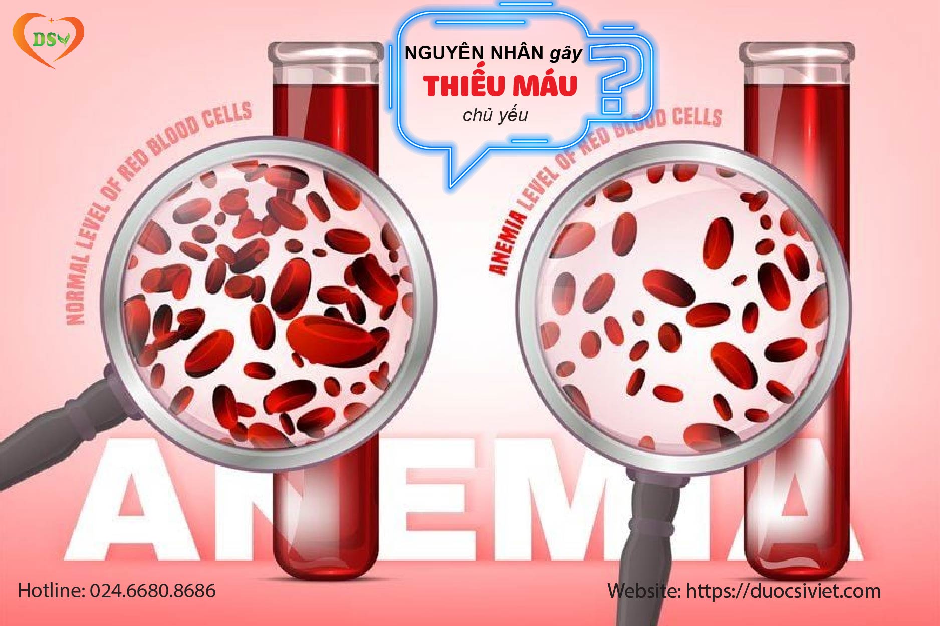 Những nguyên nhân thiếu máu chủ yếu
