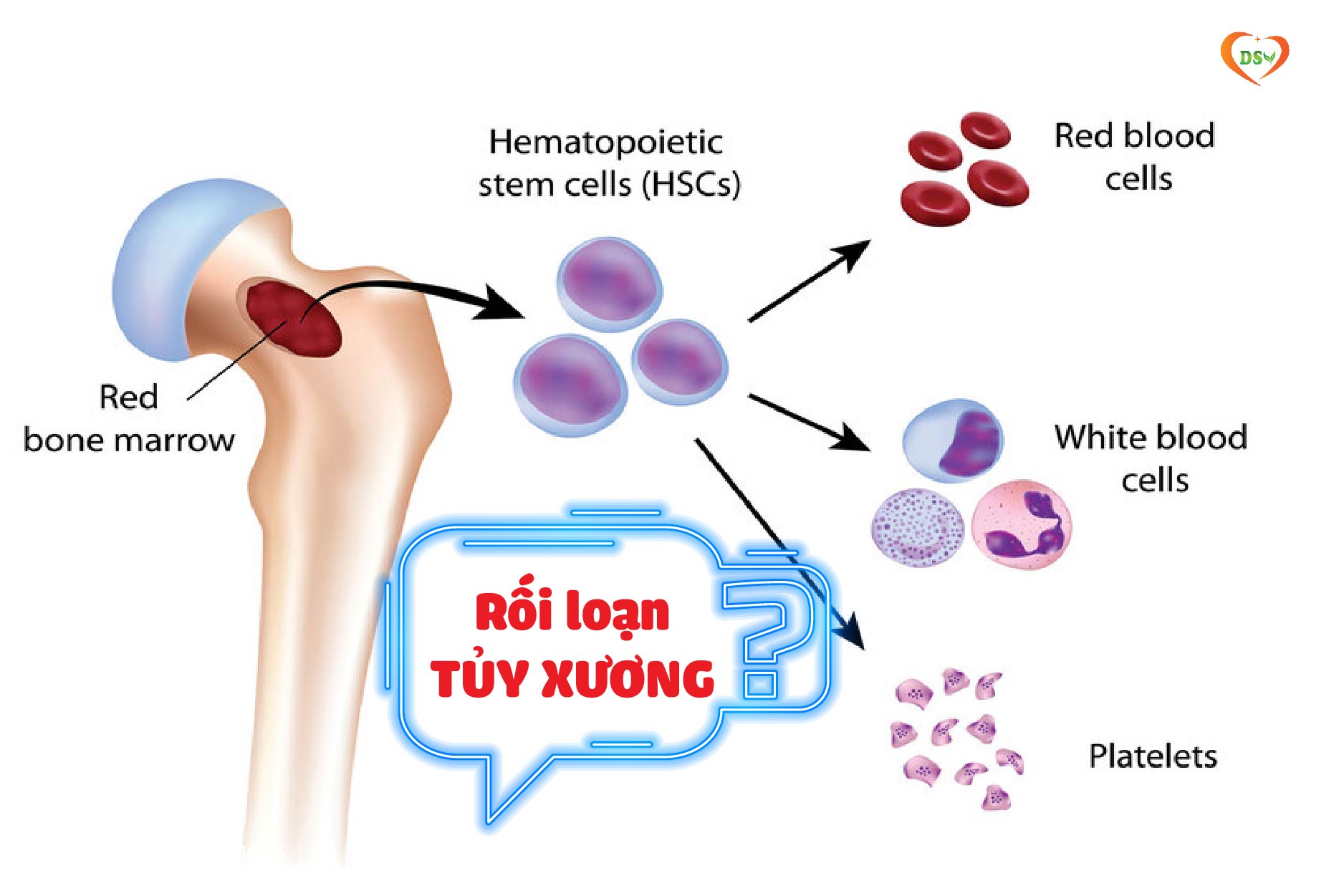 Những nguyên nhân thiếu máu chủ yếu
