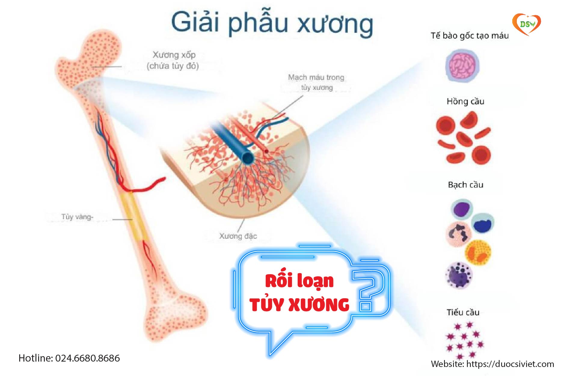 Có phải cứ thiếu máu đều cần bổ sung sắt
