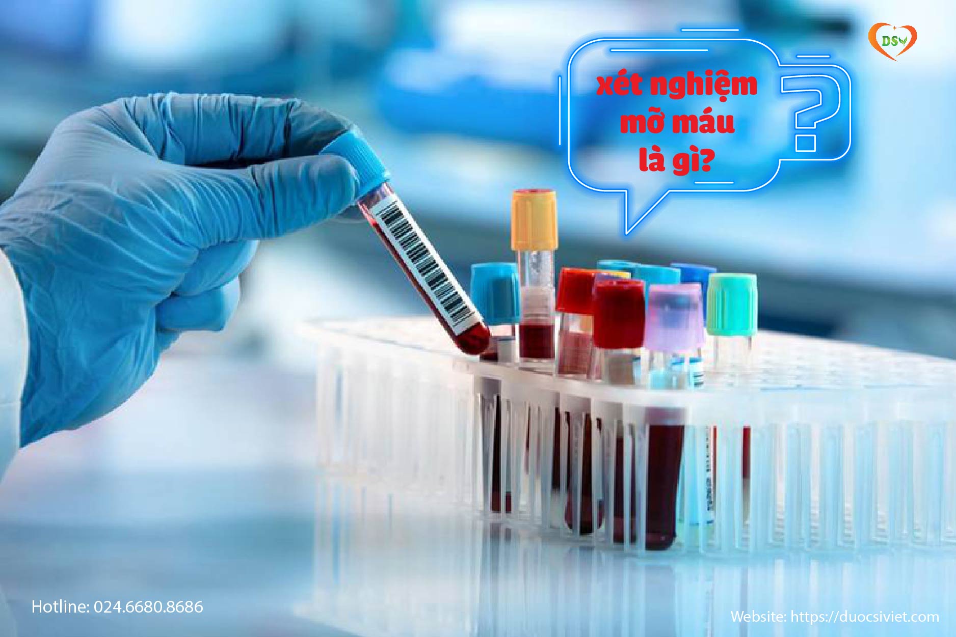 Kiểm tra chỉ số mỡ máu như thế nào khi cầm tờ xét nghiệm máu
