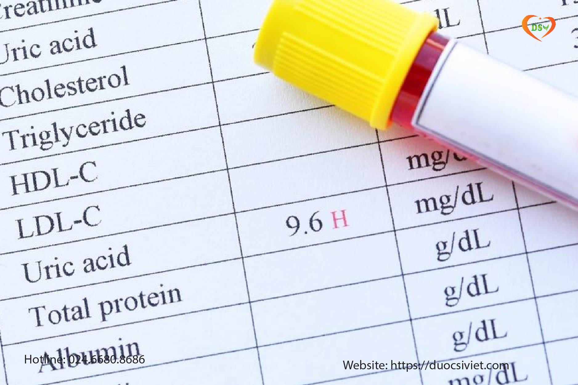 Kiểm tra chỉ số mỡ máu như thế nào khi cầm tờ xét nghiệm máu
