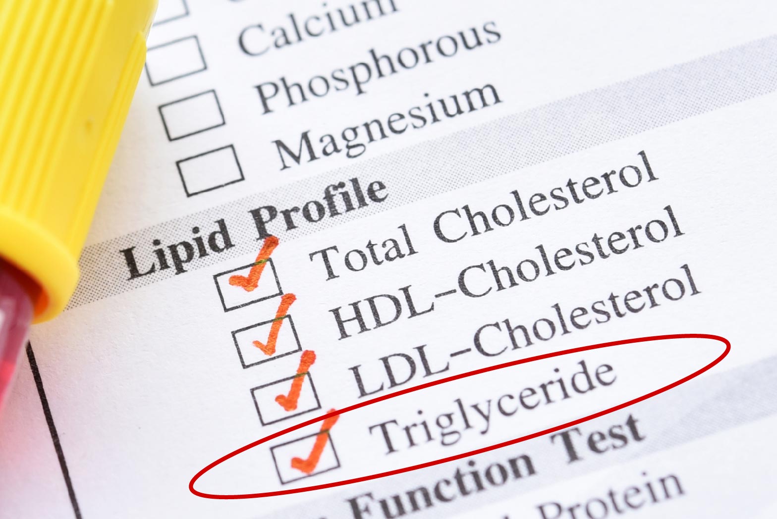 Các thông số mỡ máu chính khi xét nghiệm máu
