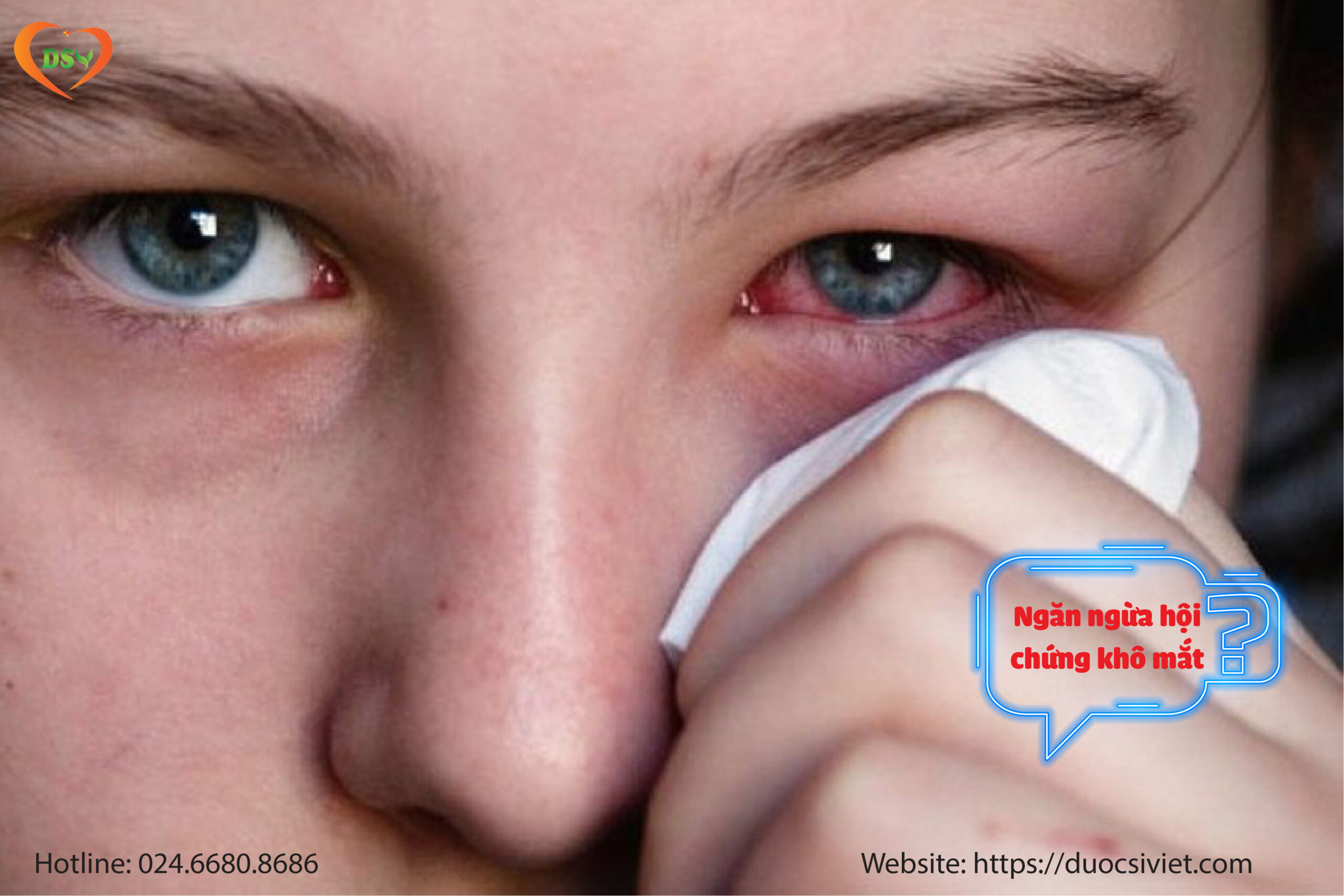 Dưỡng mắt giúp Ngăn ngừa hội chứng Khô mắt (Dry Eye Syndrome)