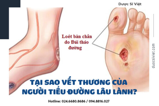 Tại-sao-vết-thương-của-người-tiểu-đường-lâu-lành