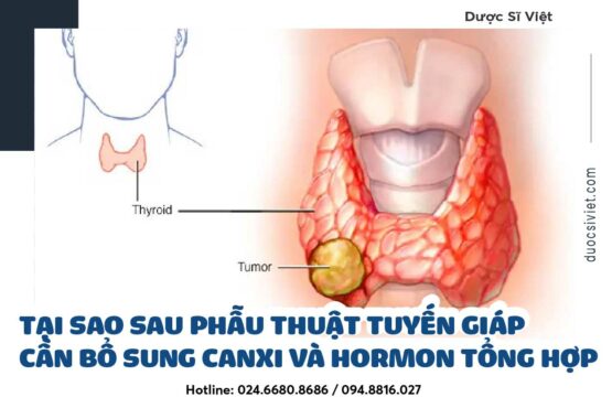 Tại sao sau phẫu thuật tuyến giáp cần bổ sung hormon và Canxi