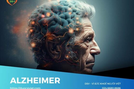 Bệnh lý Alzheimer
