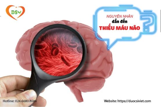 Nguyên nhân dẫn đến thiếu máu não