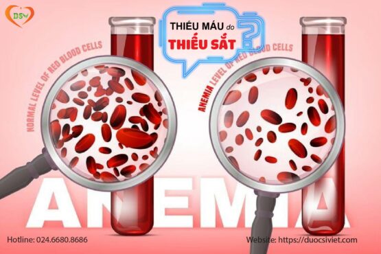 Thiếu máu do thiếu sắt có đặc điểm gì