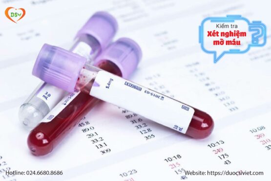 Kiểm tra chỉ số mỡ máu như thế nào khi cầm tờ xét nghiệm máu