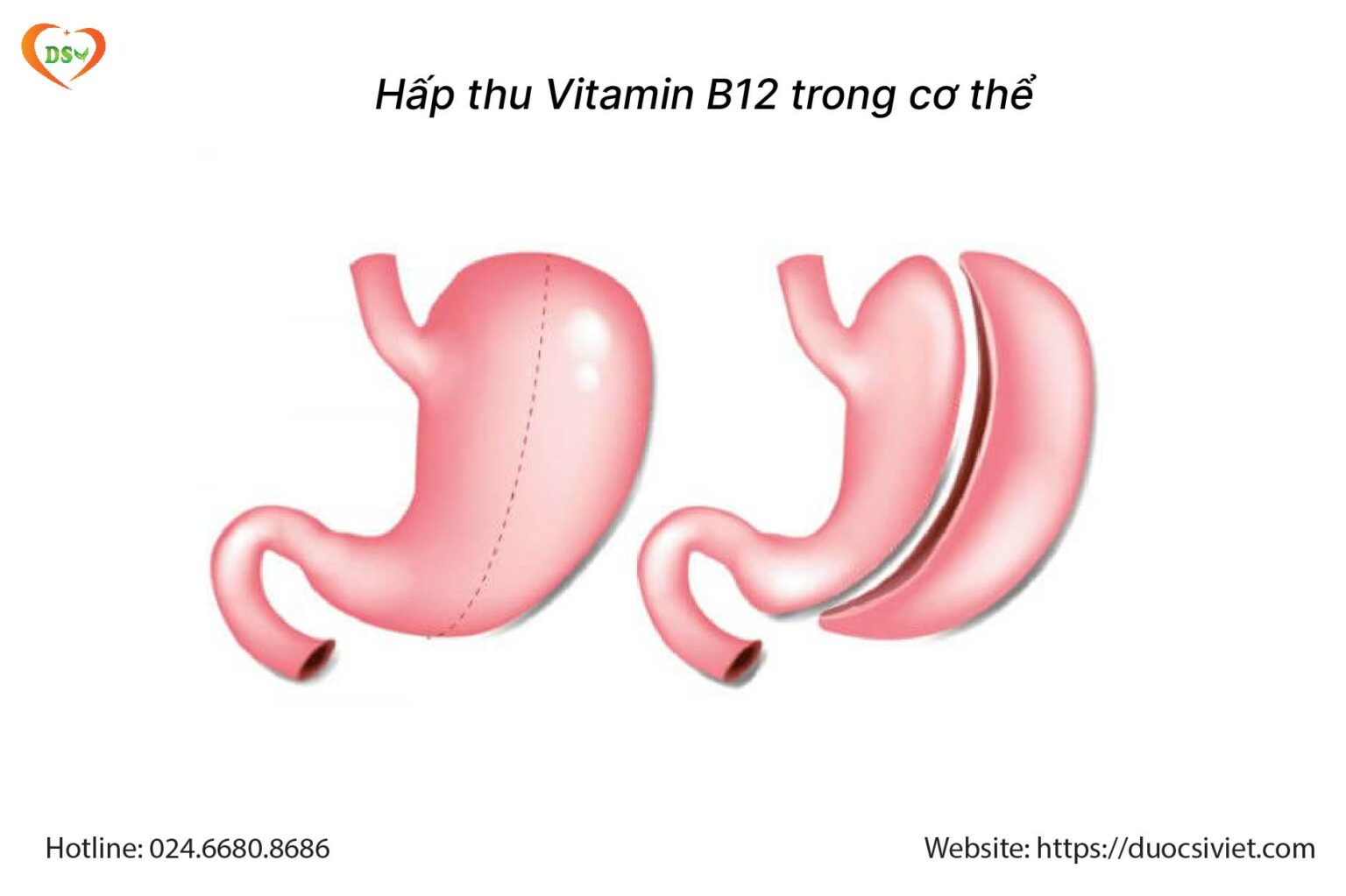 Hấp thu Vitamin B12 trong cơ thể